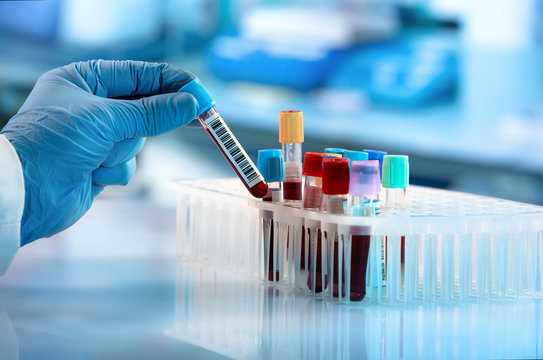 Batch creation of result test types